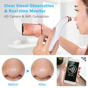 WiFi Blackhead Remover Wireless Camera Monitor